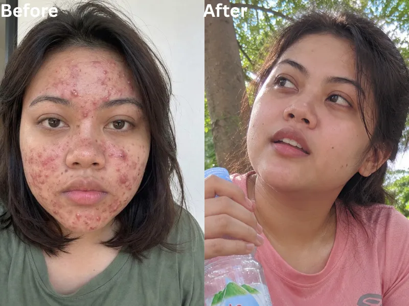 Foto before dan after pengalaman pembaca