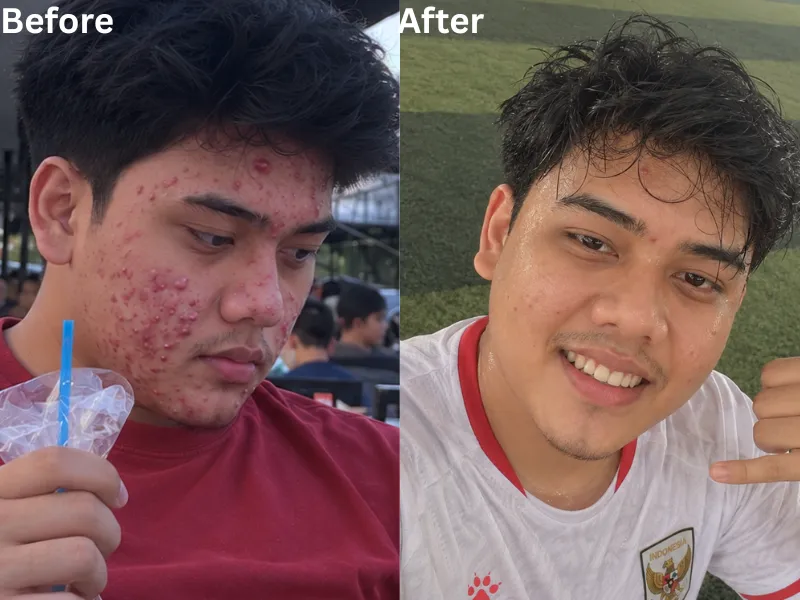 Foto perubahan kulit dalam dokumentasi